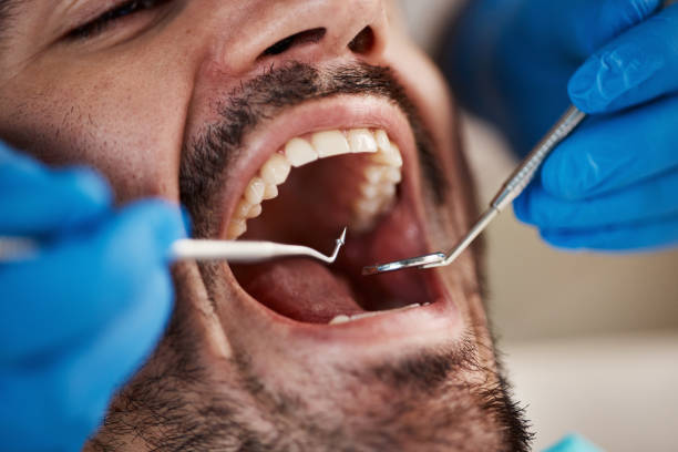 Best Knocked-Out Tooth Emergency  in Harlowton, MT
