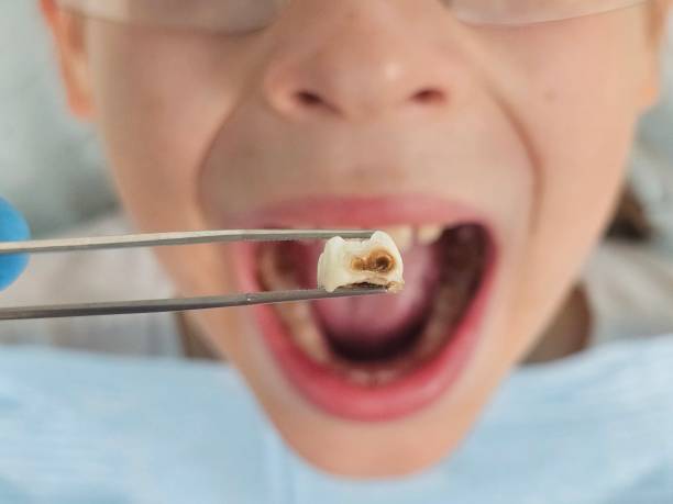 Emergency Gum Pain Relief in MT