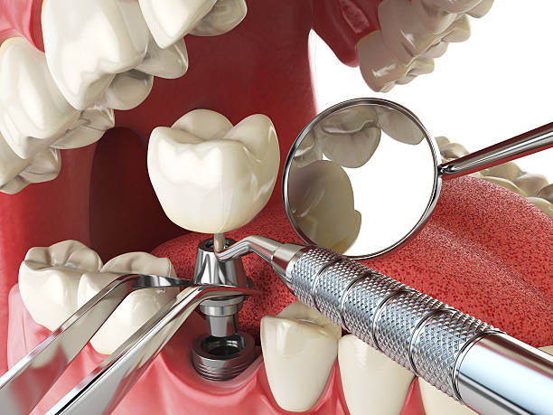Best Emergency Gum Pain Relief  in Harlowton, MT